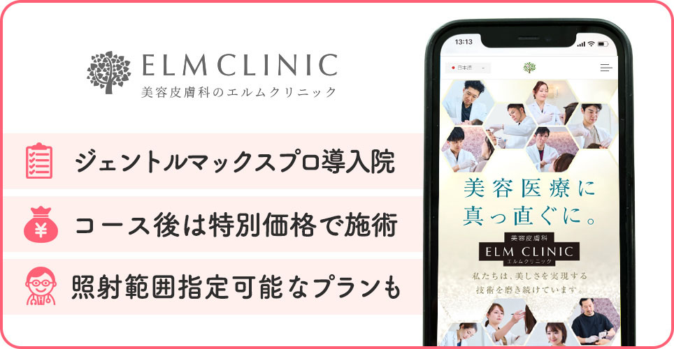 エルムクリニックの医療脱毛特徴まとめバナー