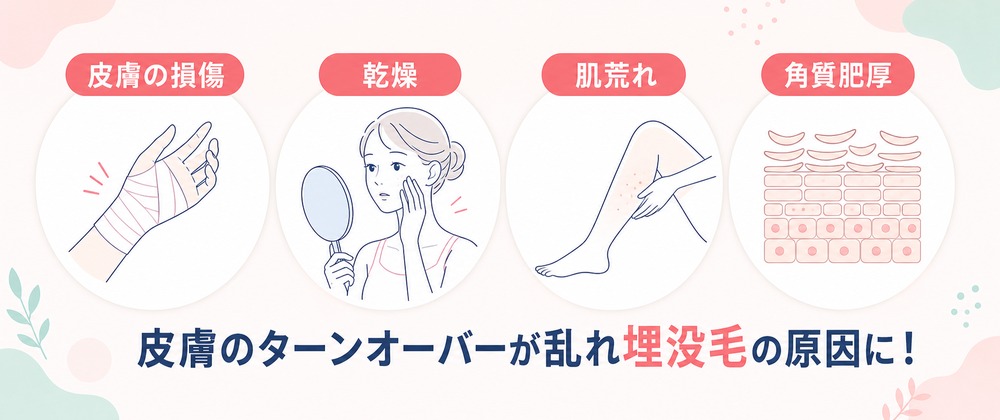 埋没毛とは？埋もれ毛になる原因