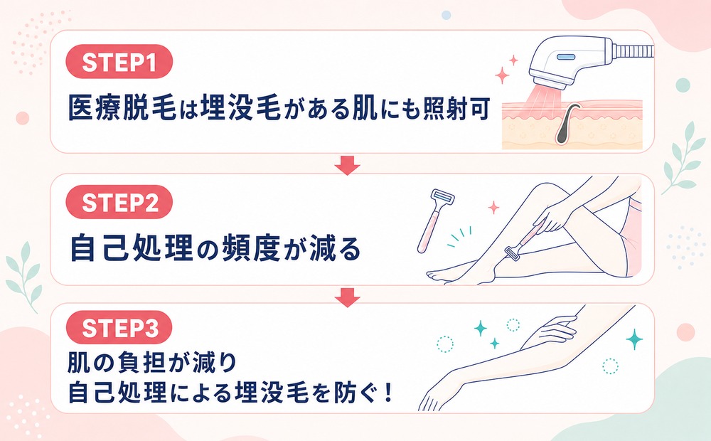 埋没毛は脱毛で治る！？レーザー脱毛後はどうなるか効果を解説