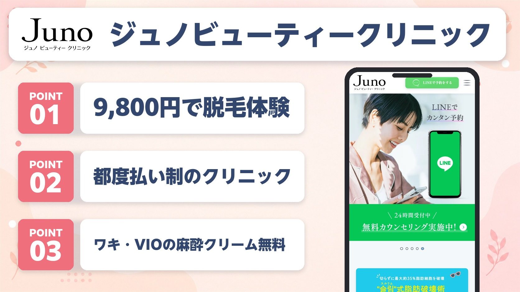 ジュノビューティークリニックの医療脱毛特徴まとめ