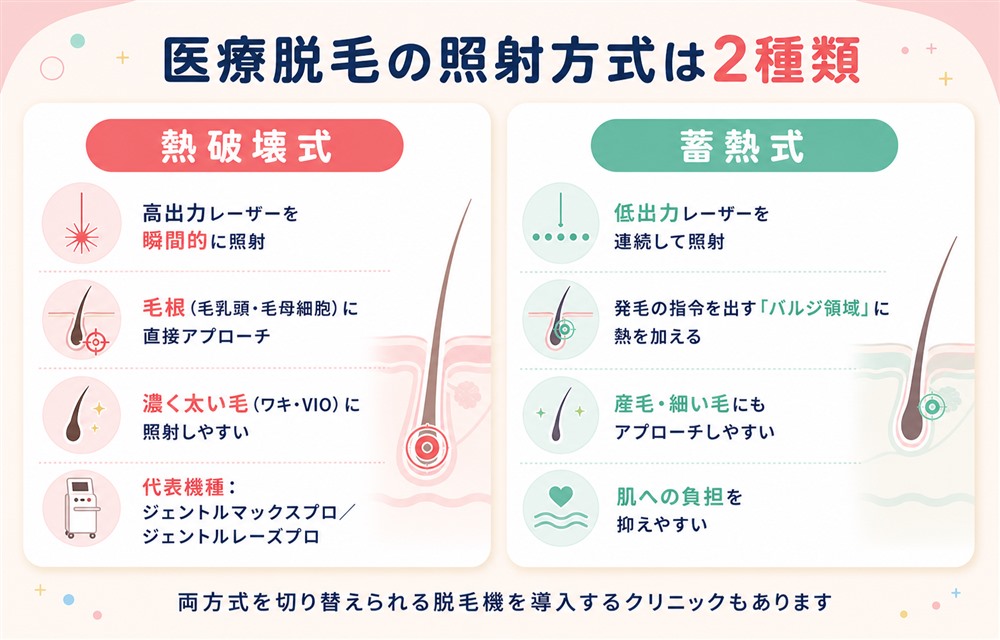 医療脱毛の熱破壊式と蓄熱式の違い