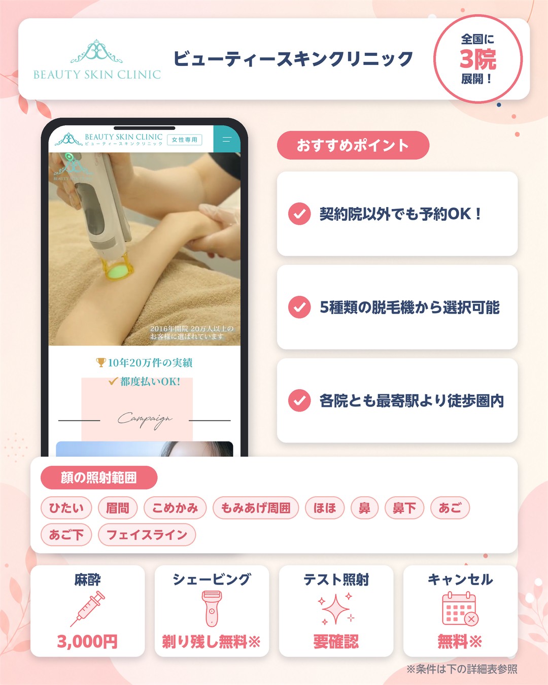 ビューティースキンクリニックの顔脱毛の特徴