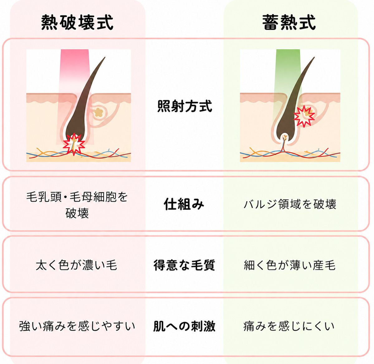 熱破壊式と蓄熱式の違い(照射方式・仕組み・得意な毛質・肌への刺激)