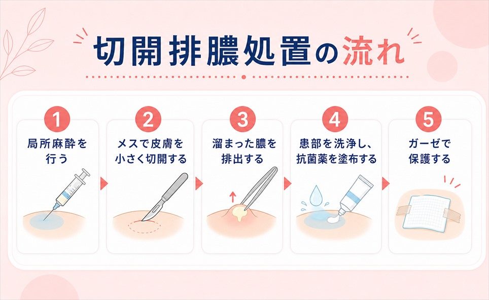 毛嚢炎(毛包炎)が悪化・治らない場合は病院を受診