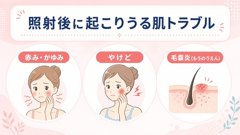 照射後の肌トラブルの紹介