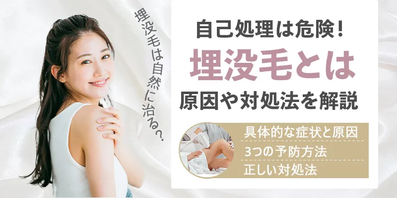埋没毛の治し方と治らないときの対処法！原因・予防もあわせて解説