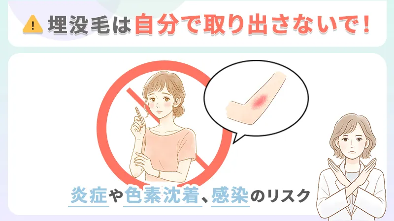 埋没毛を自分で取り出す行為は危険