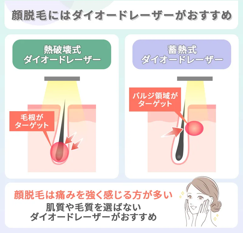 顔脱毛に使用するレーザー脱毛機の種類