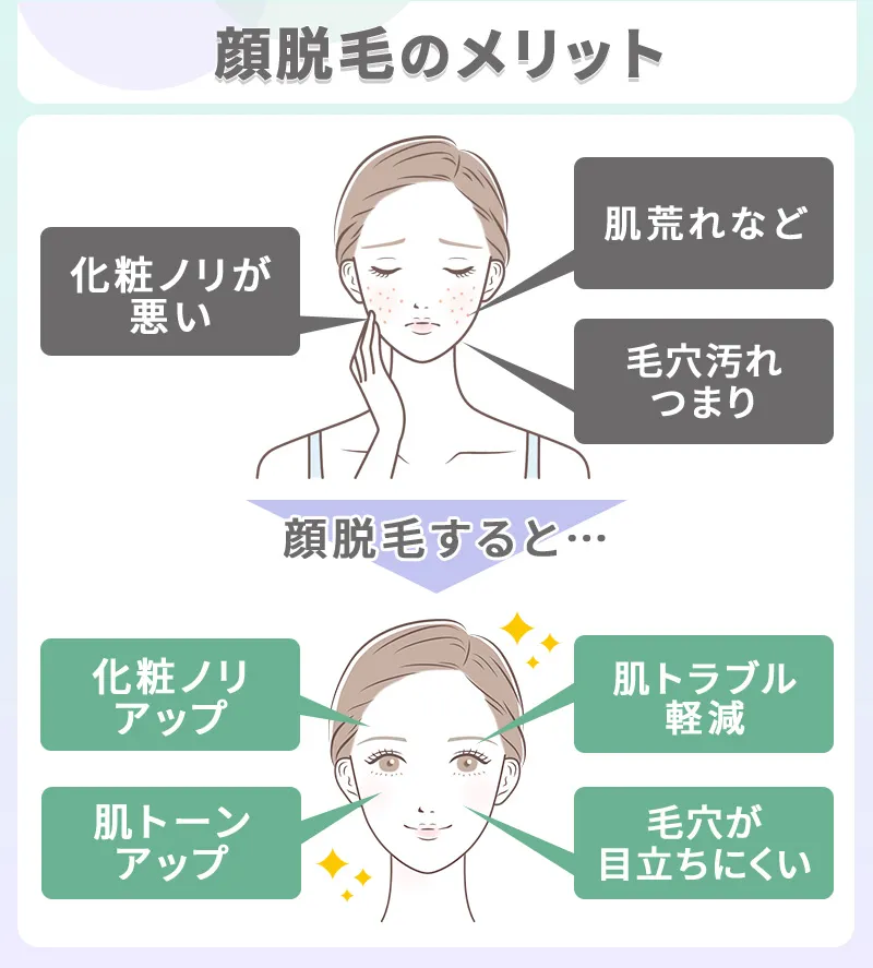 顔脱毛のメリット