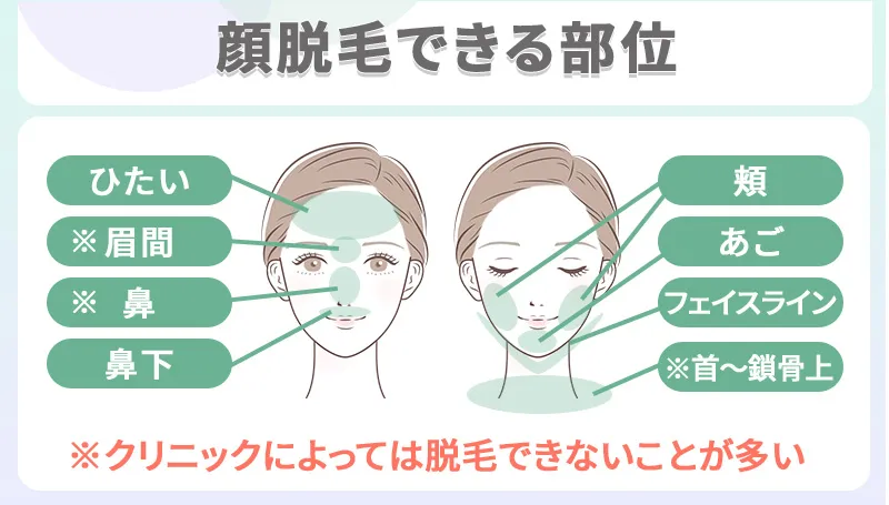 顔脱毛できる部位