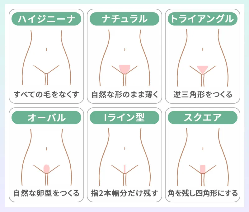 VIO脱毛の人気デザイン