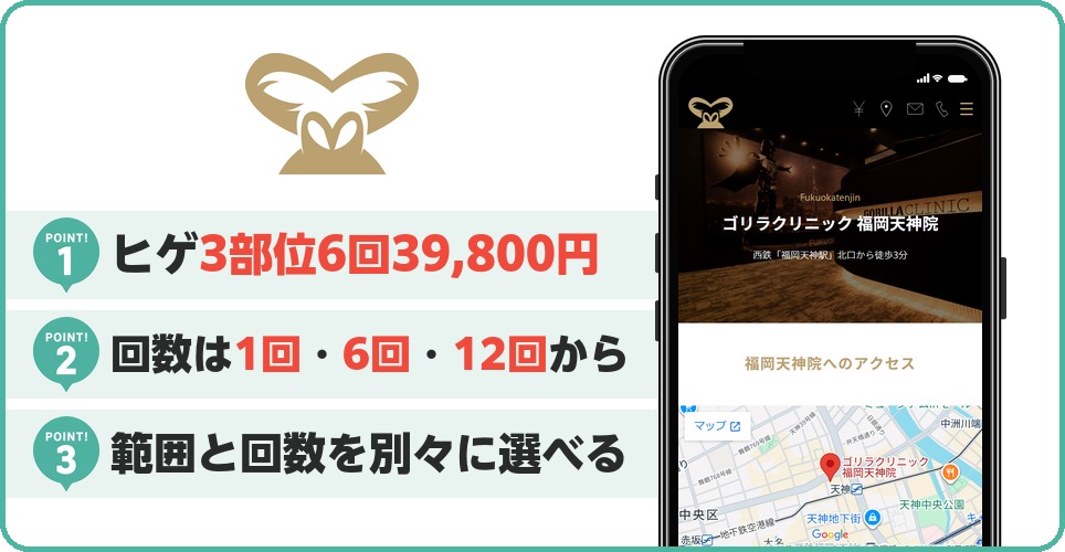 ゴリラクリニックの特徴まとめ