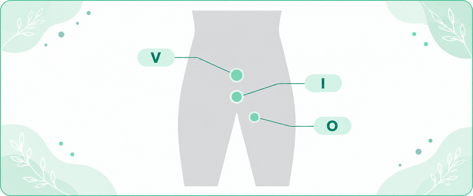 男性のVIO脱毛でV・I・Oがそれぞれどの範囲を指すかを人体のピクトグラムで示す図