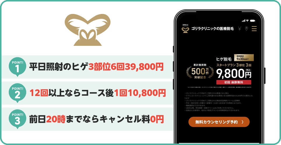 ゴリラクリニックの特徴まとめ