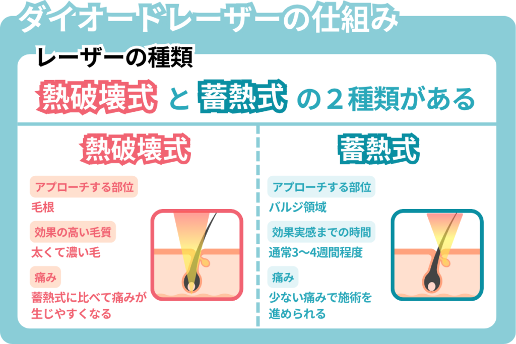 ダイオードレーザーの仕組みの説明