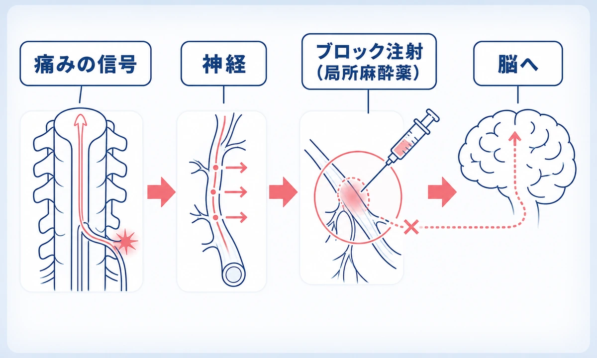 block-injection_img01
