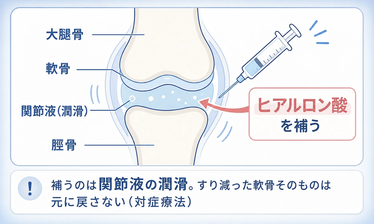膝のヒアルロン酸注射の目的と働きを解説