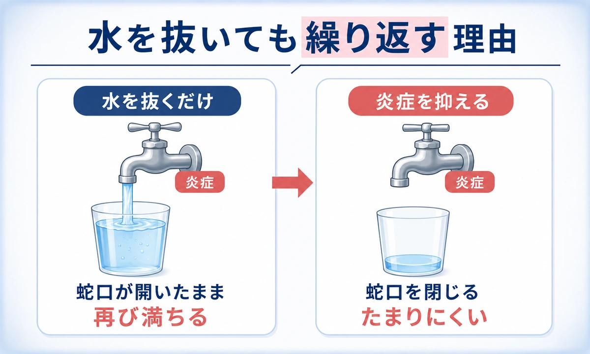 膝の水を抜くと癖になる？繰り返す本当の理由