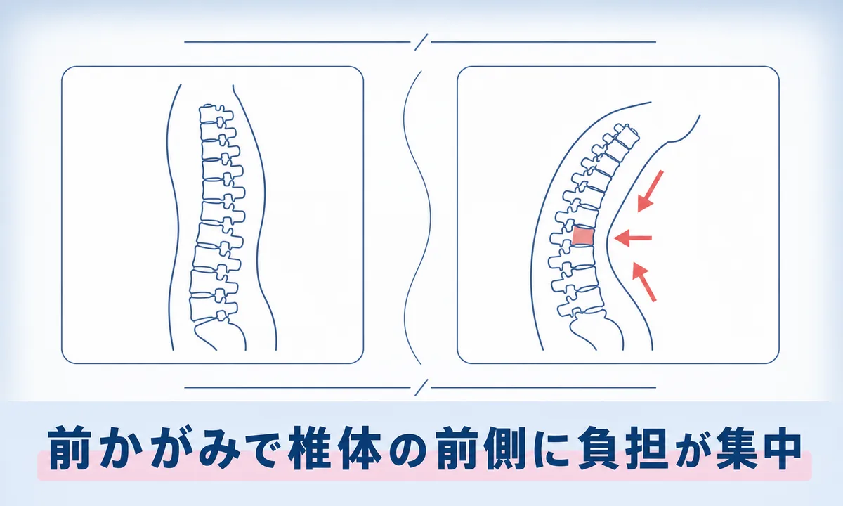 圧迫骨折で悪化させる姿勢と日常のNG動作