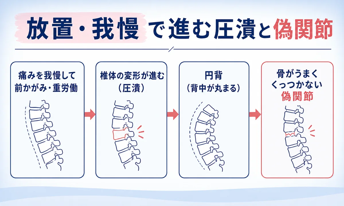 圧迫骨折を放置するとどうなる？続発骨折・円背(猫背)のリスク