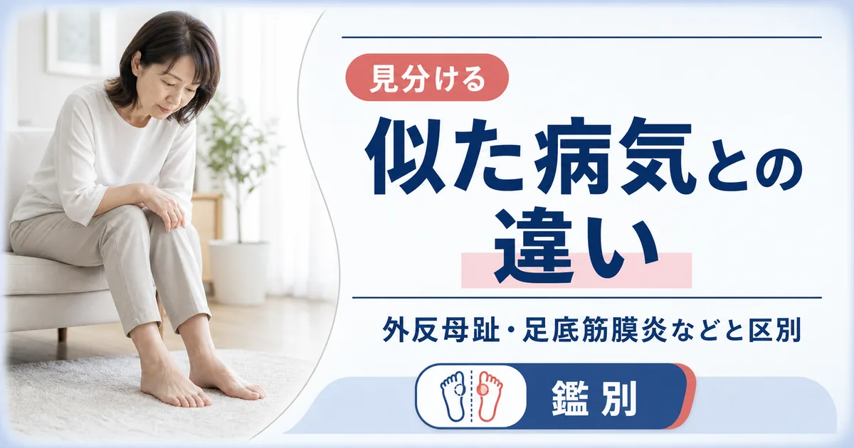 モートン病と外反母趾や足底筋膜炎などとの違い