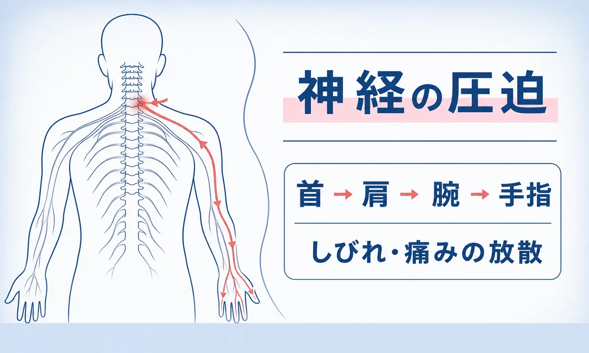 首の痛みに頭痛やしびれが重なるとき