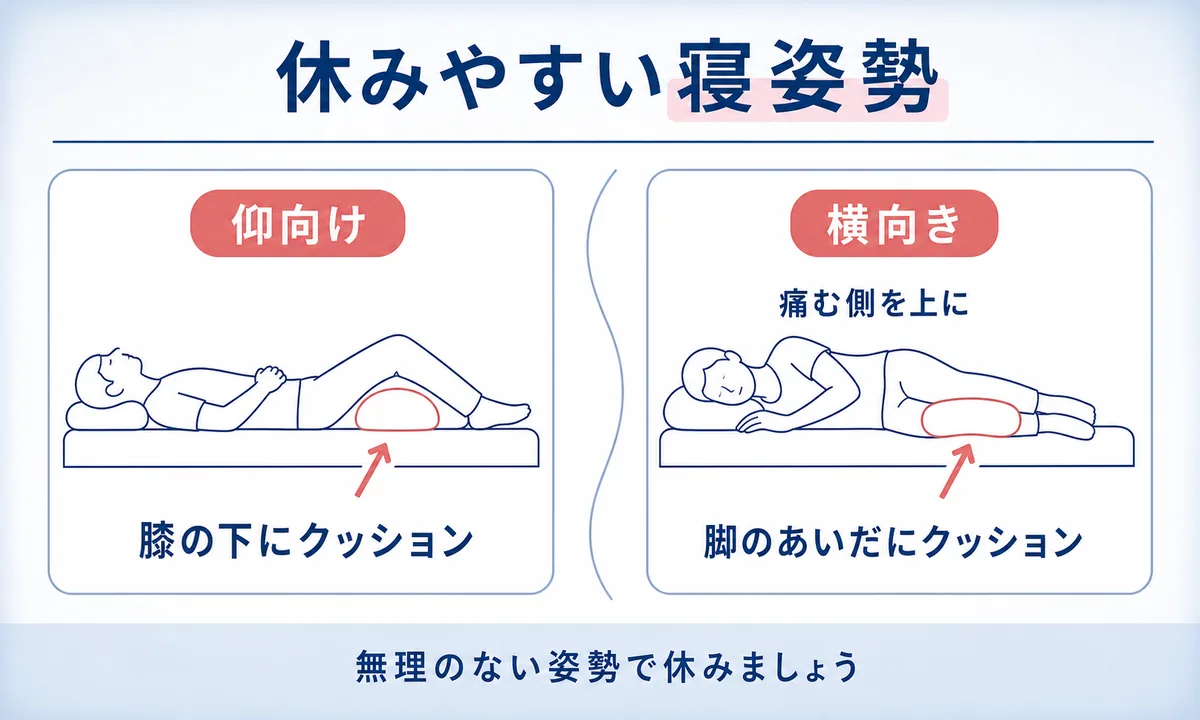 梨状筋症候群でやってはいけないことと悪化を防ぐ過ごし方