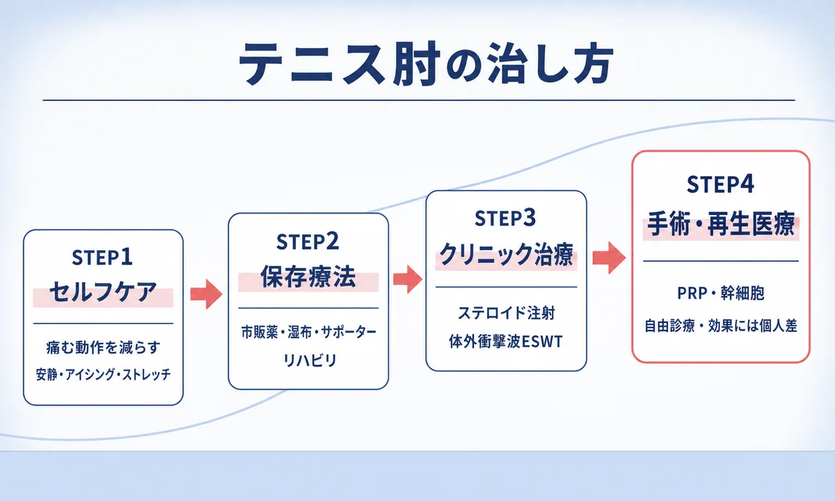 テニス肘の治し方の段階と自分でできる対処法