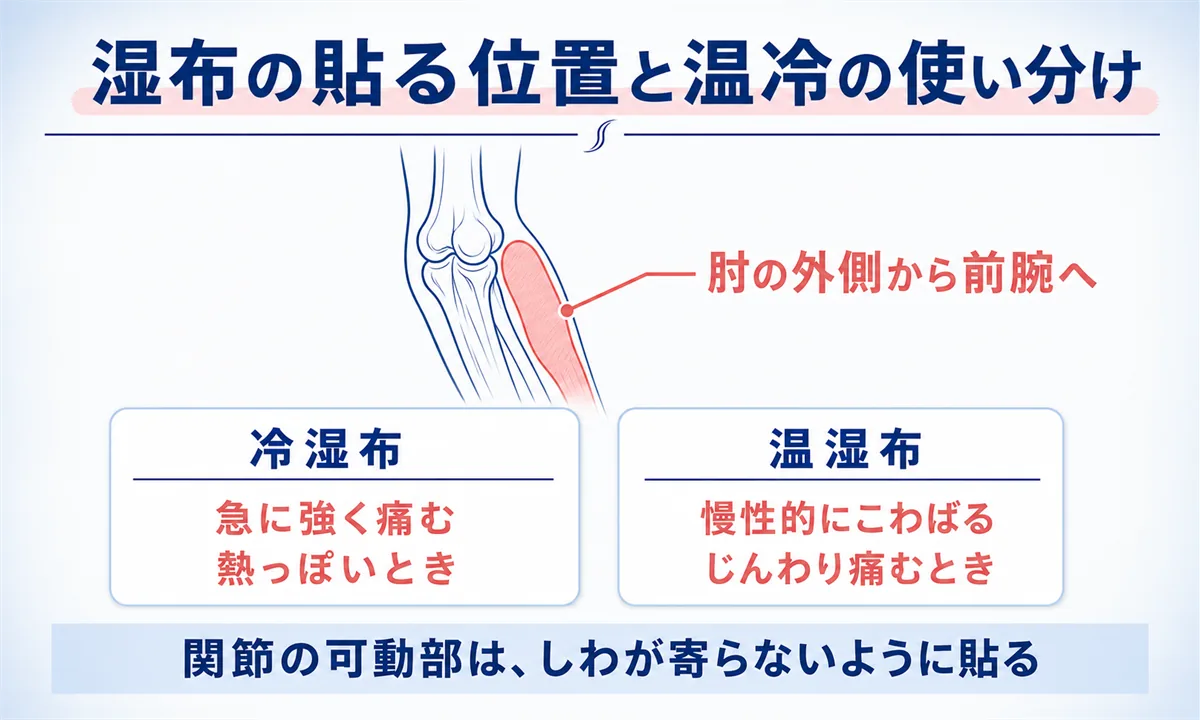 テニス肘に効く市販薬と湿布の選び方