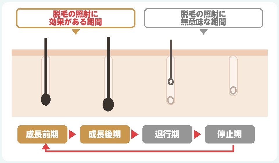 毛周期のと脱毛照射が効果の有無の期間の図説
