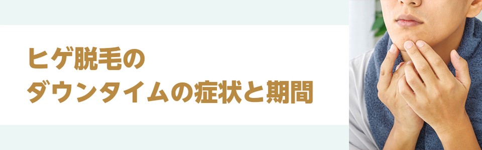 ヒゲ脱毛のダウンタイムの症状と期間