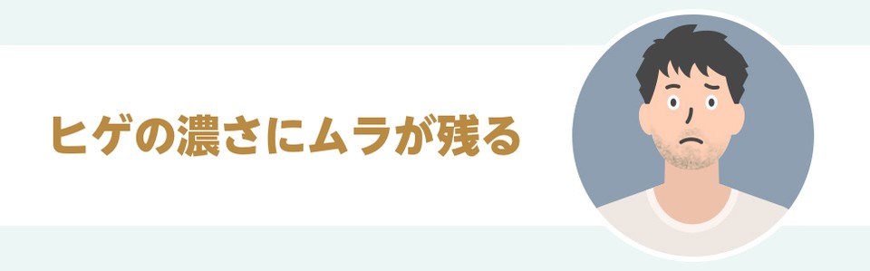 ヒゲの濃さにムラが残る