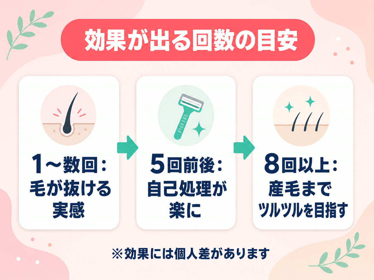 エミナルクリニックの医療脱毛で効果を実感する回数の段階の目安を示す図解