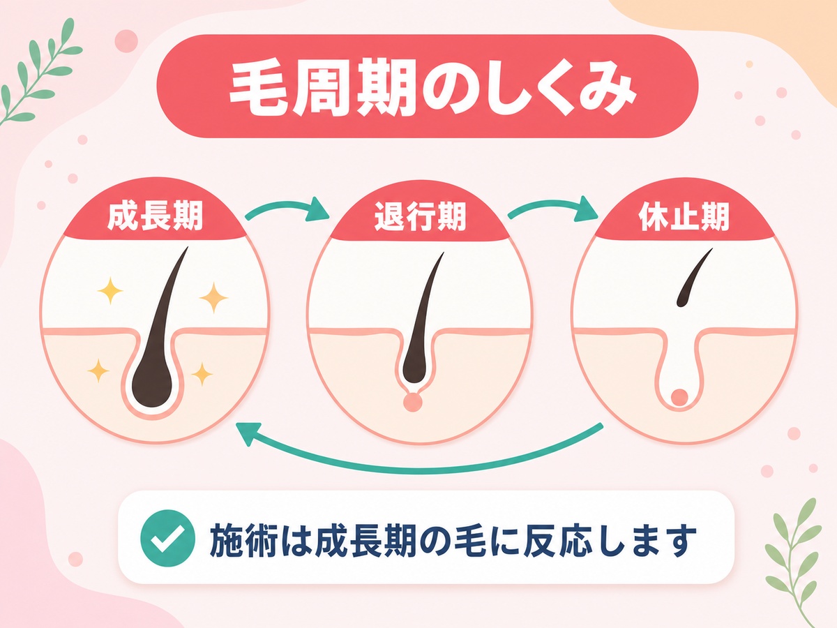 毛周期（成長期・退行期・休止期）と医療脱毛の関係を示す図解