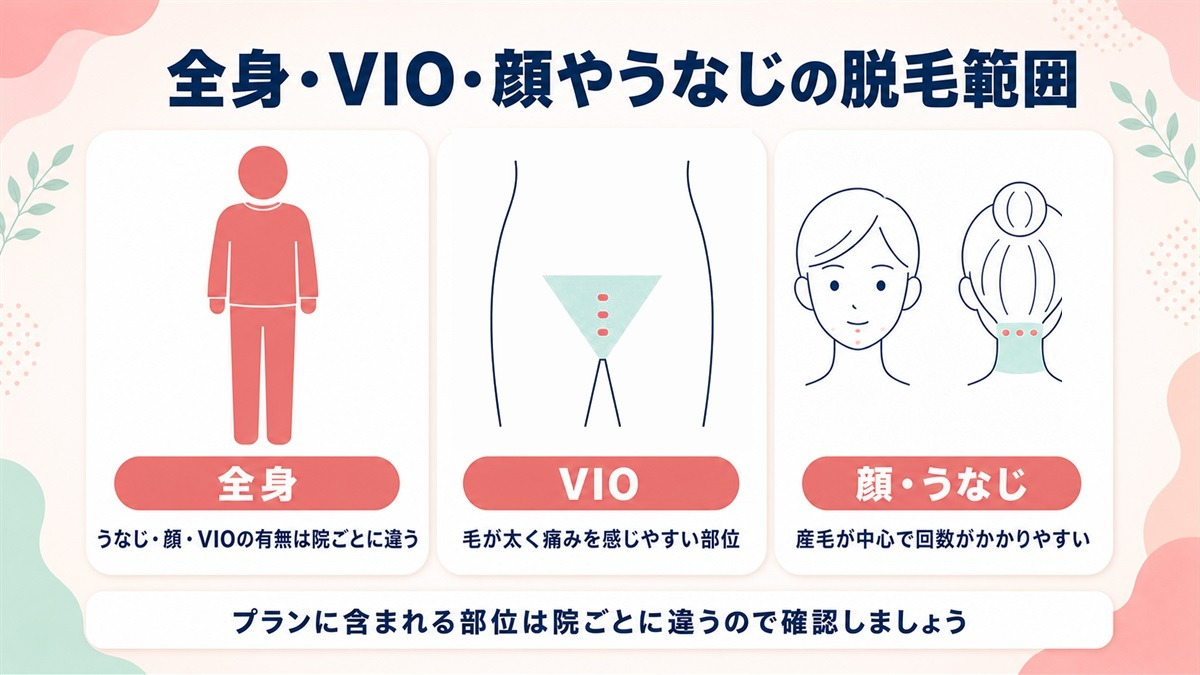 全身・VIO・顔うなじの脱毛範囲を示した模式図