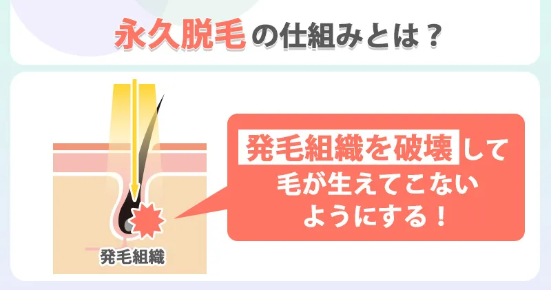 永久脱毛の仕組み