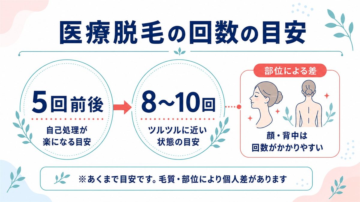 医療脱毛の回数目安を自己処理が楽になる5回前後とツルツルに近い8〜10回で示し顔と背中は回数がかかりやすいと補足した図解