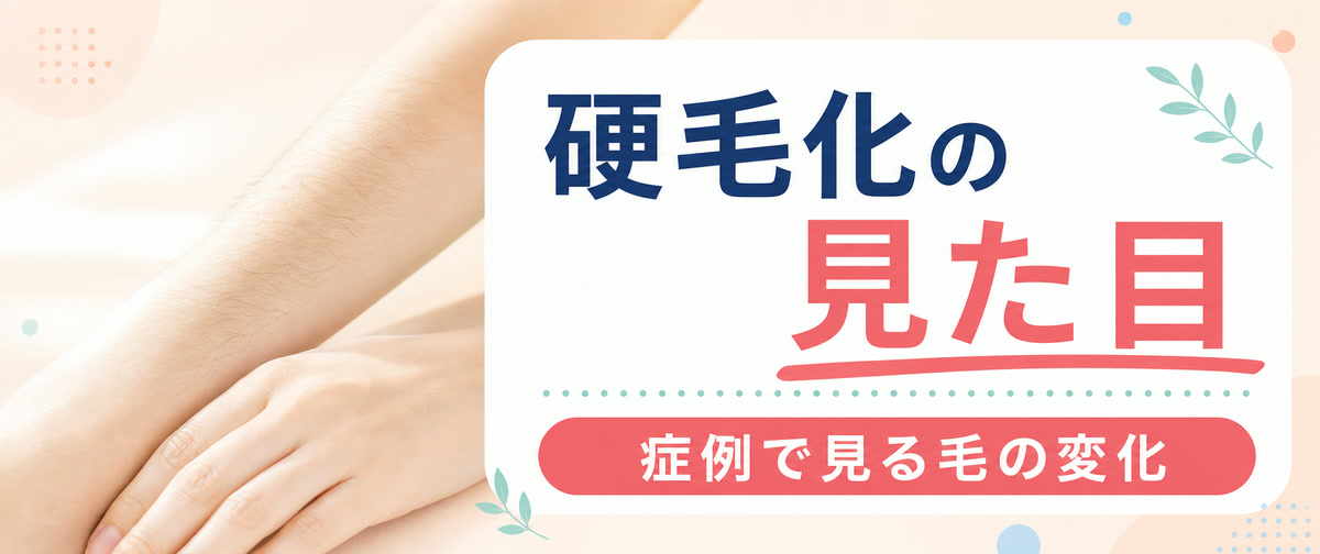 硬毛化の見た目・症例
