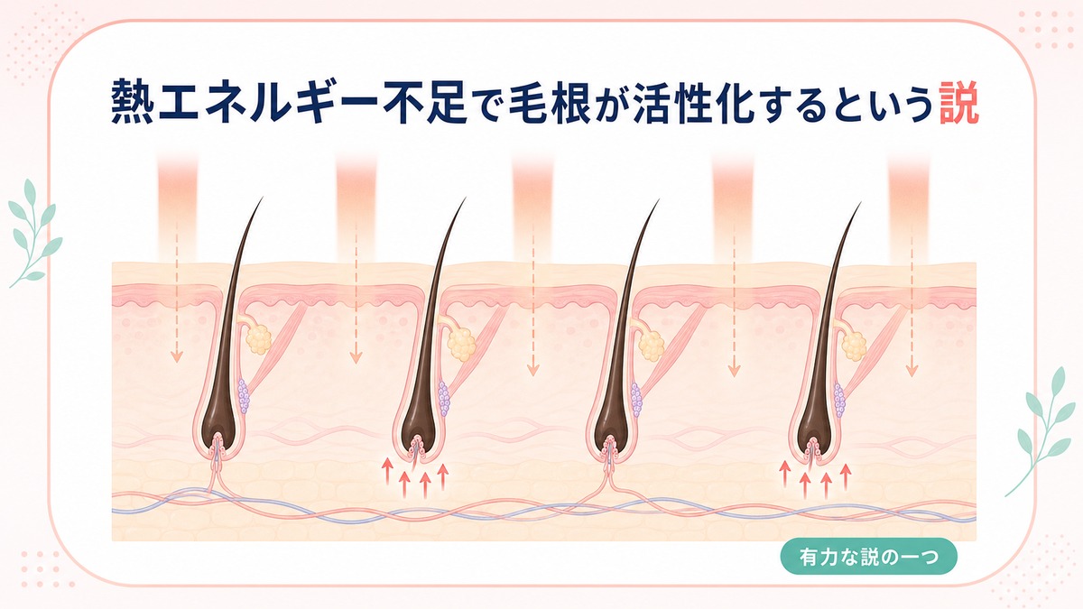 硬毛化の原因は？なぜ脱毛で毛が濃くなるのか