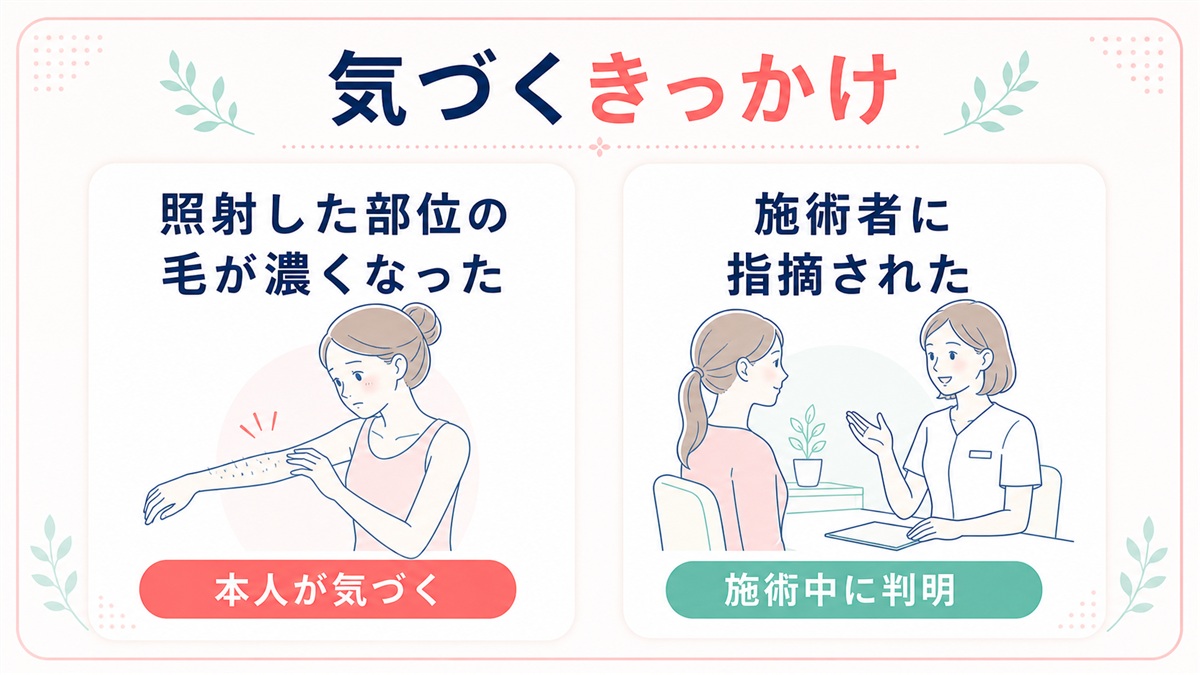 硬毛化はいつ・何回目に起こる？経過の目安