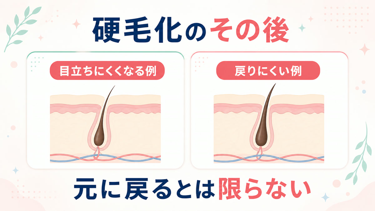 硬毛化は治る？元に戻るのか