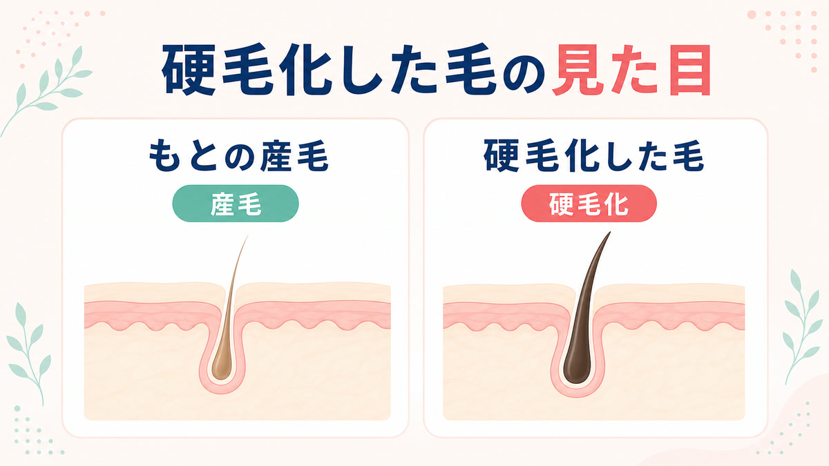 硬毛化の見た目・症例