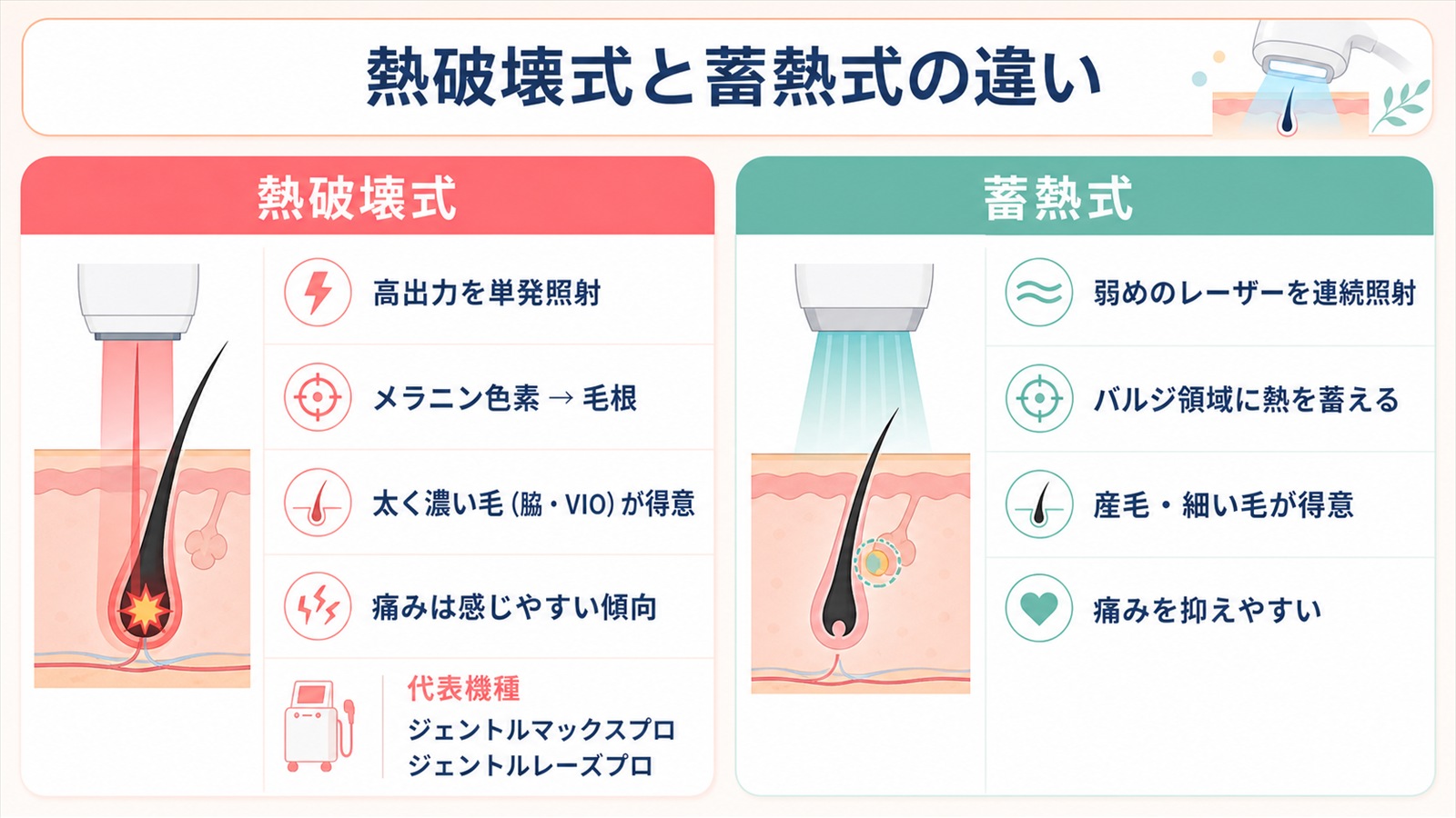 熱破壊式と蓄熱式のレーザーの違い