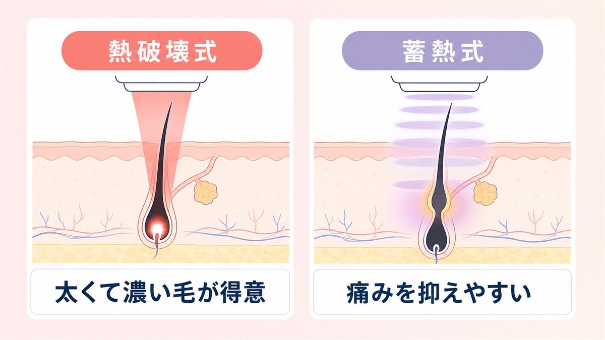沖縄の医療脱毛クリニックが導入している脱毛機を比較