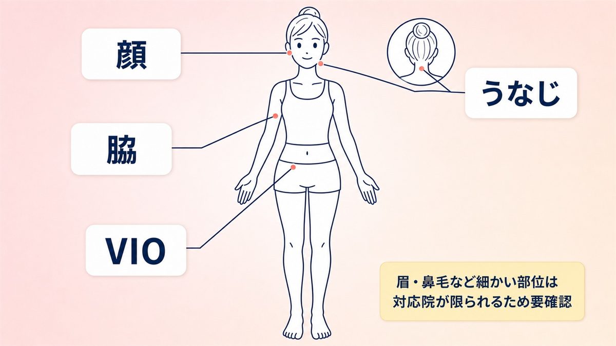 部分脱毛でも受けられる？沖縄の医療脱毛でVIOや顔だけのプランがあるクリニック