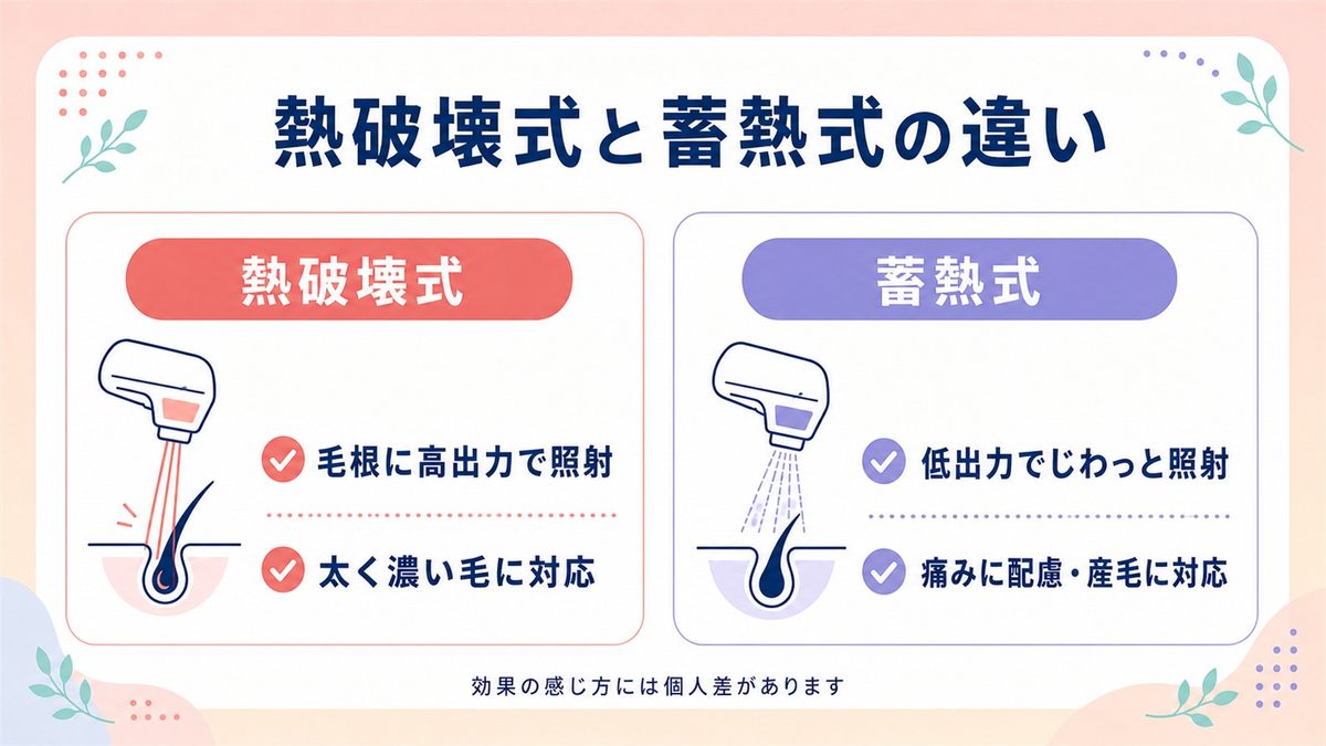 大宮の医療脱毛で使われる脱毛機の種類と照射方式