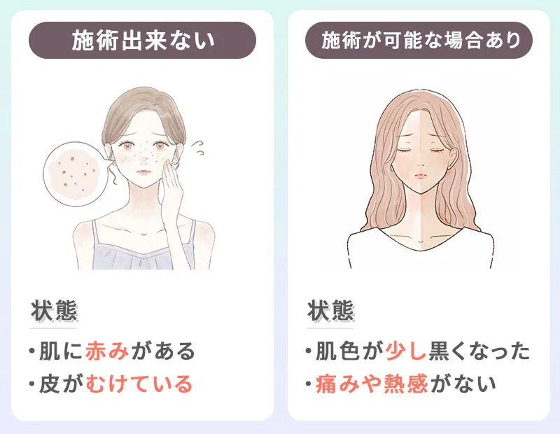 脱毛施術の可否を分ける日焼けの基準