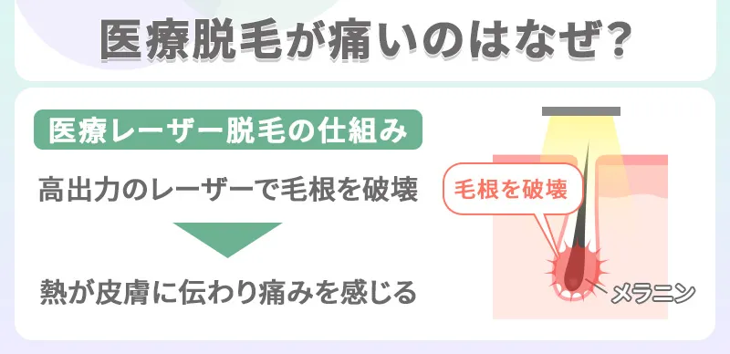 医療レーザー脱毛で痛みを感じる理由