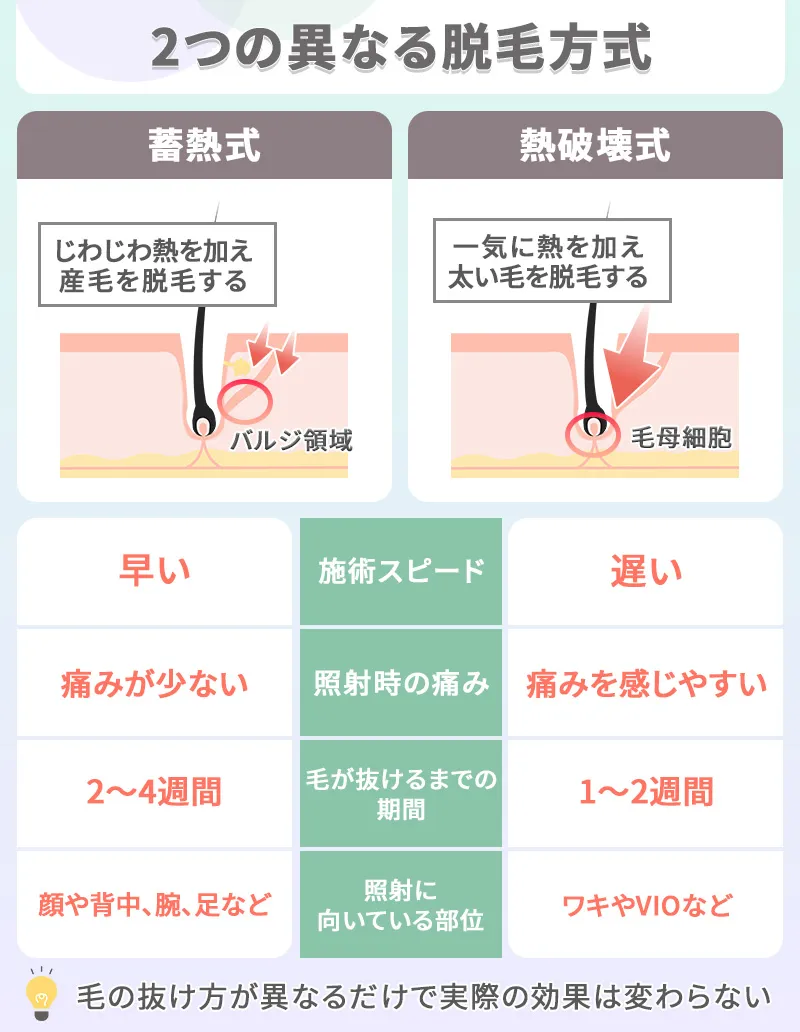 レーザー脱毛機の蓄熱式と熱破壊式