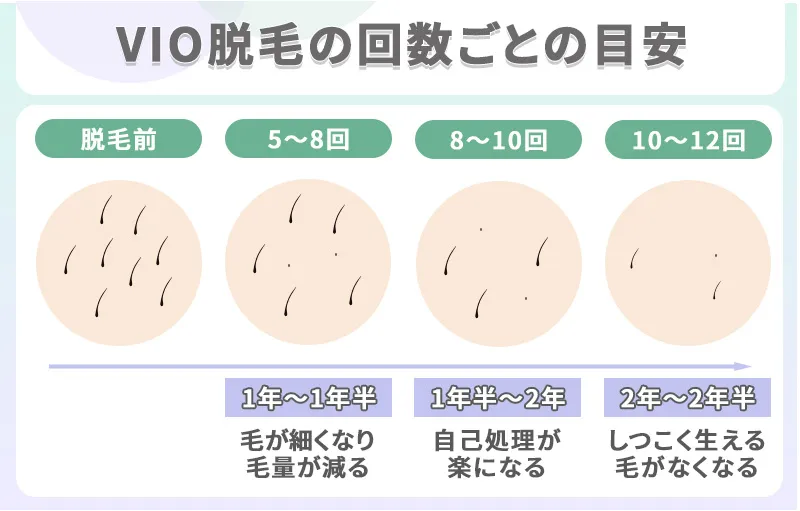 VIO脱毛の回数ごとの目安
